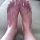 Illustration for article titled Ow! My Feet! Or, I Am an Idiot